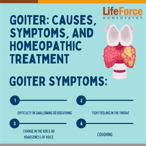 Goiter Causes Symptoms And Homeopathic Treatment