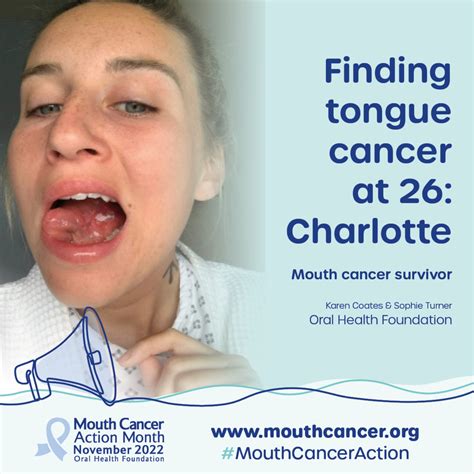 Finding Tongue Cancer At 26 My Mouth Cancer Story The Oral Health Podcast On Acast