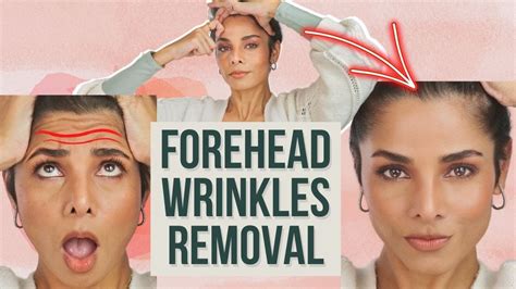 How To Remove Forehead Wrinkles And Tighten Forehead Skin Without Botox Youtube