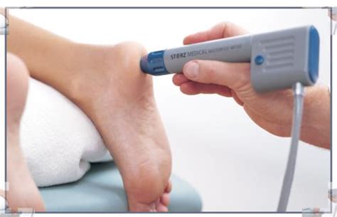 What Is Extracorporeal Shock Wave Therapy Sutherland Podiatry