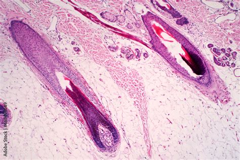 Histology Of Human Scalp And Hair Follicle Under The Light Microscope