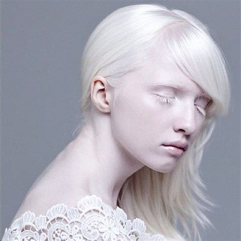 Days Of Demons Nastya Zhidkova Albino Model Albinism Pale Beauty