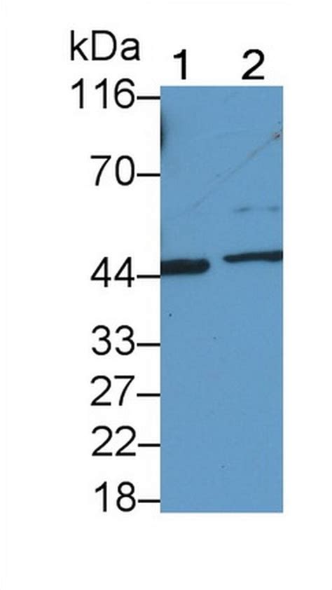 Il31ra Polyclonal Antibody Pa5 119229