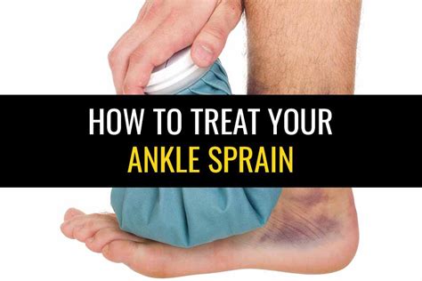 Ankle Sprain Treatment Sprained Ankle Exercises Sports Injury Physio