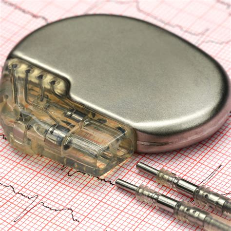 Pacemakers Top Brands Per Segment In The Us Idata Research