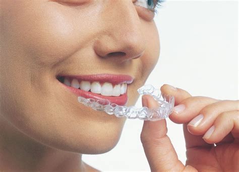 Invisalign Dre Isabelle Baillargeon Orthodontiste