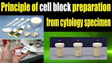 Biopsia Simples Imprint E Cell Block