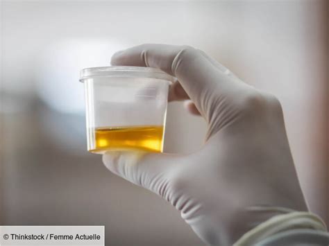 Détecter certains cancers avec un test d urine bientôt possible Femme Actuelle Le MAG