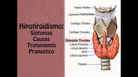 Sintomas Del Hipotiroidismo