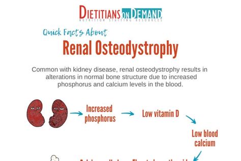Quick Facts About Renal Osteodystrophy Infographic Dietitians On Demand