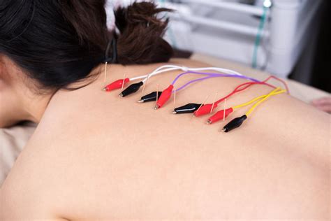 Find Relief Now Acupuncture For Chronic Pain And Inflammation