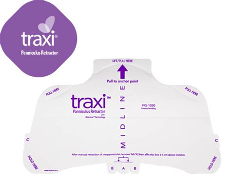 Traxi® Panniculus Retractor Mer Limited