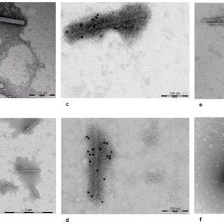 Electron Microscopy Of Pepper Mild Mottle Virus Pmmov Rna Positive