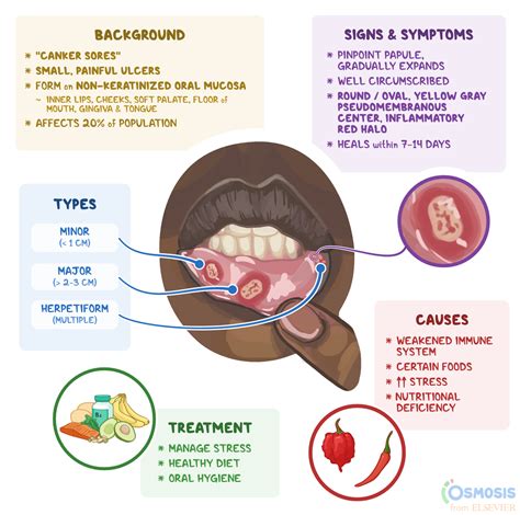 Canker Sore Floor Of Mouth