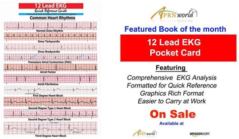 12 Lead Ekg Pocket Card Aprn World Nursing Books Ekg