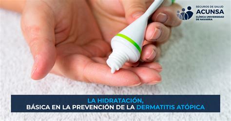 5 Claves Para Prevenir La Dermatitis Atópica