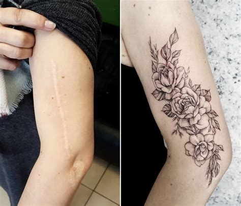 Turn Scars Into Your Own Unique Beauty Thanks To These Beautiful Tattoos Art Of Life