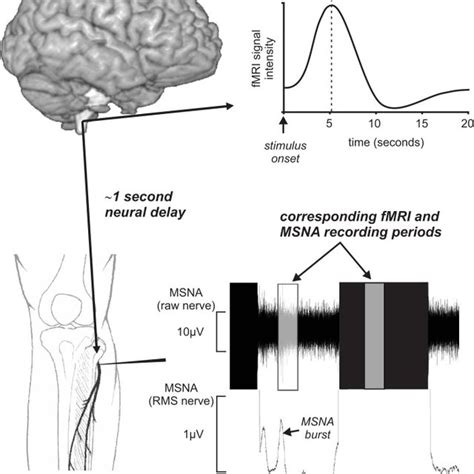 Functional Magnetic Resonance Imaging Fmri Signal Intensity Changes