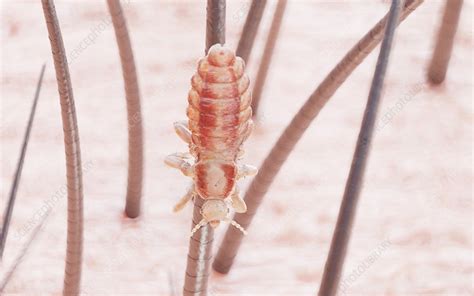 Head Louse Illustration Stock Image F0291160 Science Photo Library