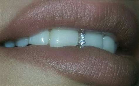 A Tooth Gap Filled With Diamonds Diamond Teeth Teeth Jewelry Gap Teeth