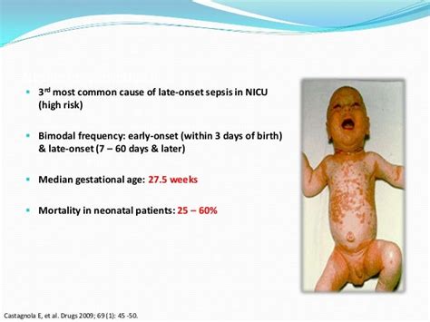 Management Of Systemic Fungal Infection In Newborn