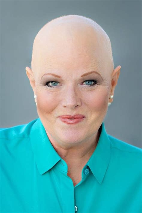 Pin By Kevin Griffin On Bald Women In Bald Women Balding Women
