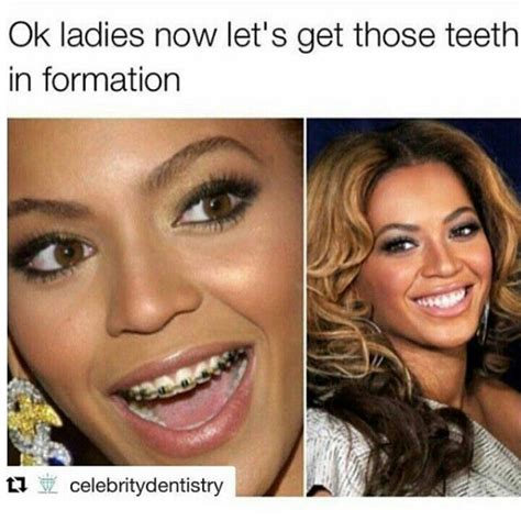 Badgalronnie Adult Braces Dental Braces Teeth Braces Braces Humor Beyonce Memes Braces