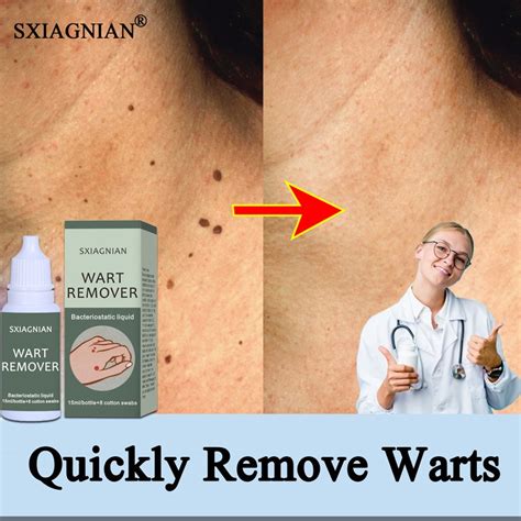 Sxiagnian Warts Remover Original Cream Warts Magic Remover Wartz
