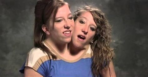 Contained In The Quiet Lives Of Conjoined Twins Abby And Brittany
