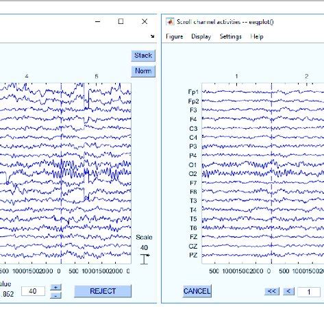 Recovered EEG Recordings The Left Figure Shows The EEG Raw Data The Download Scientific