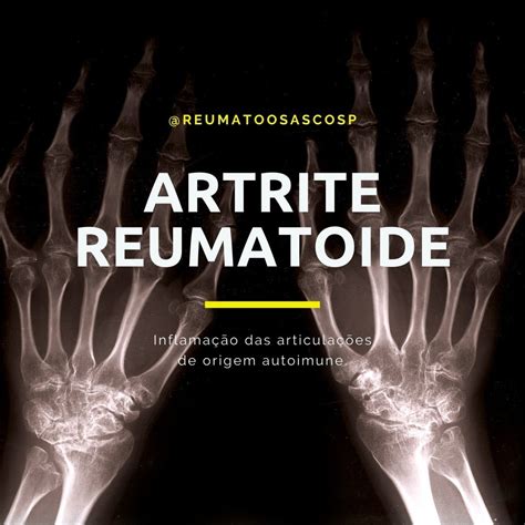 Diagnóstico Artrite Reumatoide Artrite Reumatoide