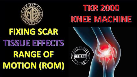 Working On Scar Tissue With Tkr 2000 For Total Knee Replacement Rehab