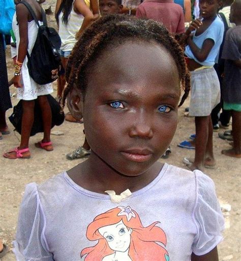 Африканские дети с голубыми глазами Zefirka