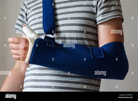 Fracture Of The Arm Hi Res Stock Photography And Images Alamy