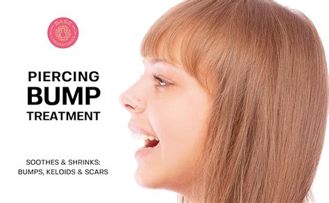 Base Labs 5 Pack Keloid Bump Removal And Piercing Bump Treatment Shrinking Drops
