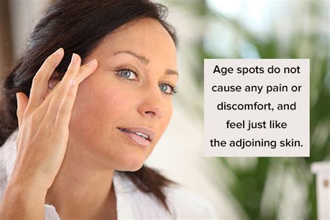 Age Spots Causes Symptoms And Medical Treatment