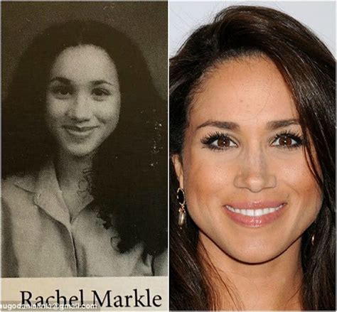 Pin By Kerry James On Au Natural Meghan Markle Plastic Surgery Nose