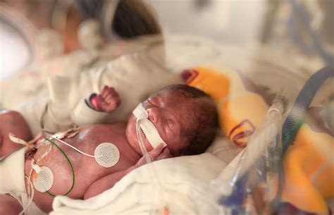 A mother camel is pregnant for 13 months. 29 Weeks Premature Baby Survival Rate - Rating Walls