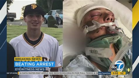 Man Arrested After Baseball Player 15 Brutally Beaten While Walking Friend Home After Game