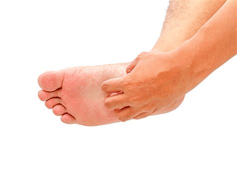 11 Most Common Foot Lumps And Bumps Explained