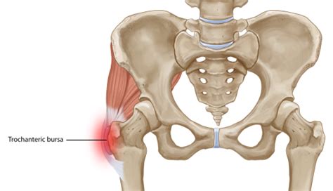 The hip joint is the articulation of the pelvis with the femur, which connects the axial skeleton with the lower extremity. Lateral Hip Pain - Dorset Chamber of Commerce and Industry