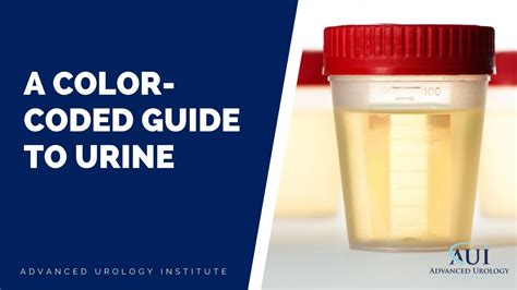A Color Coded Guide To Urine Advanced Urology Institute