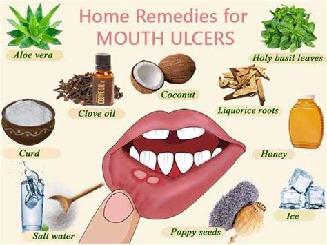 How To Heal Ulcer In Mouth