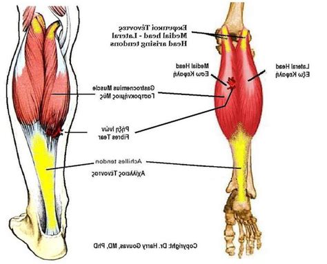 The 25 Best Gastrocnemius Muscle Ideas On Pinterest Pulled Muscle In