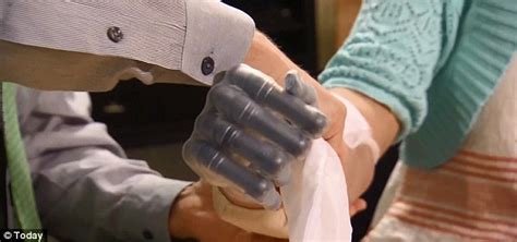 brave flesh eating bacteria victim aimee copeland shows off her new 200 000 dollar bionic hands