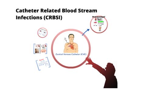 Epidemiology, pathogenesis, clinical manifestations, and diagnosis.) Catheter Related Blood Stream Infections (CRBSI) by ...