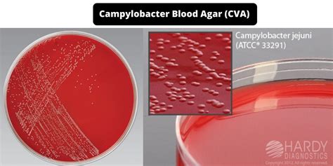 Campylobacter Blood Agar Cva Composition Principle Preparation