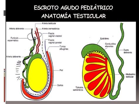 Escroto Agudo En Pediatría