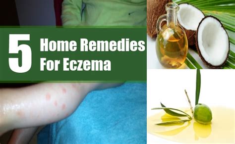 5 Home Remedies For Eczema Natural Treatments And Cure For Eczema