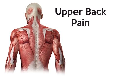 Upper Back Braces Supports For Upper Back Pain And Posture